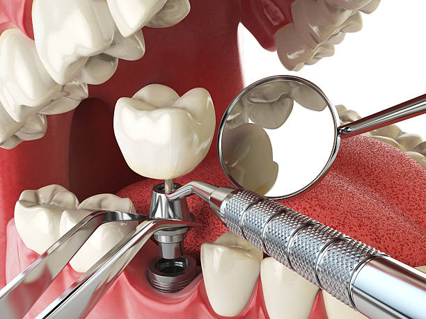  New Pek, IN Emergency Dentist Pros